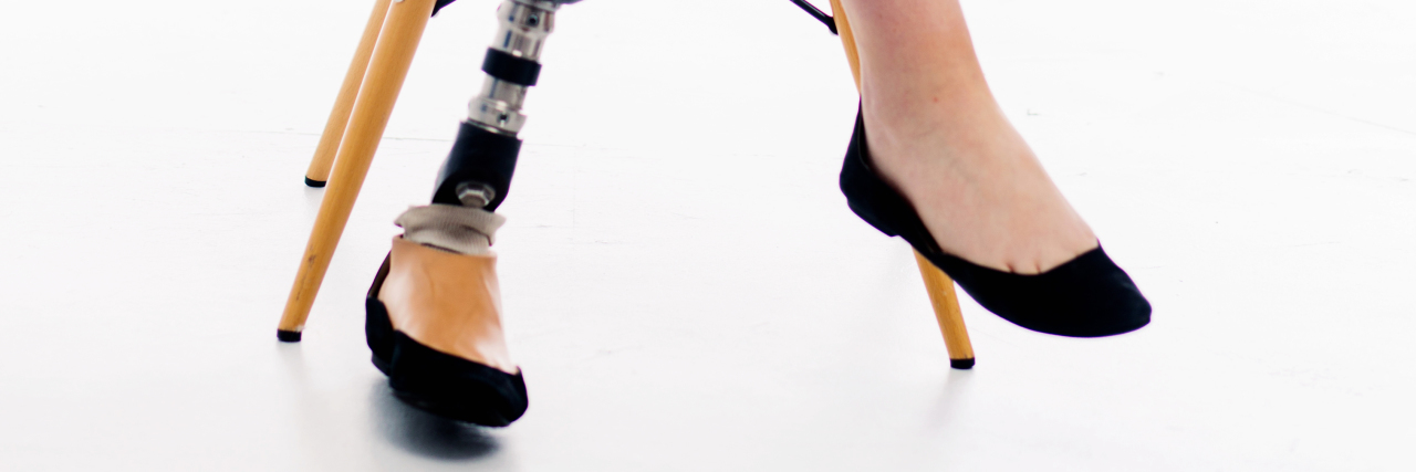 Living With Limb Amputation After Osteosarcoma Jane Peterson.