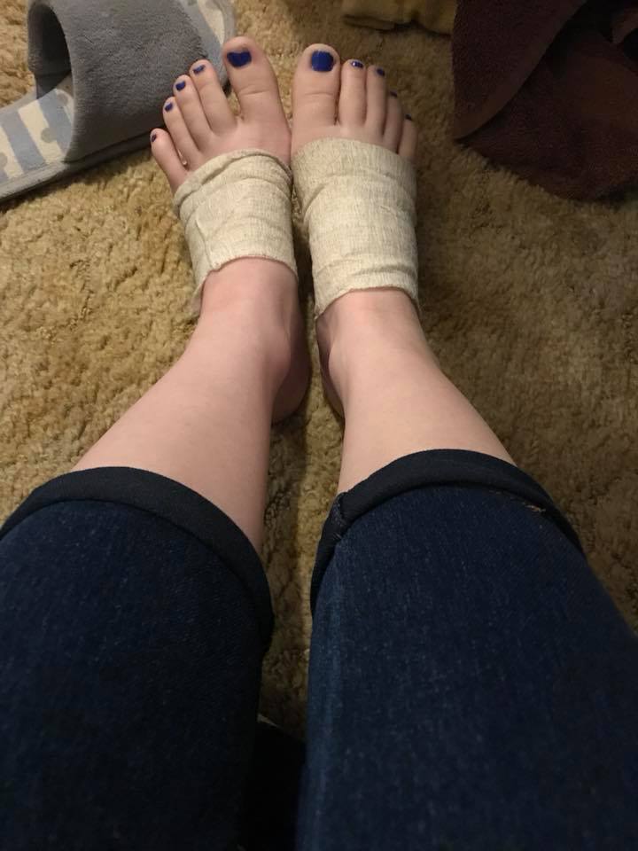 woman's feet wrapped in bandages