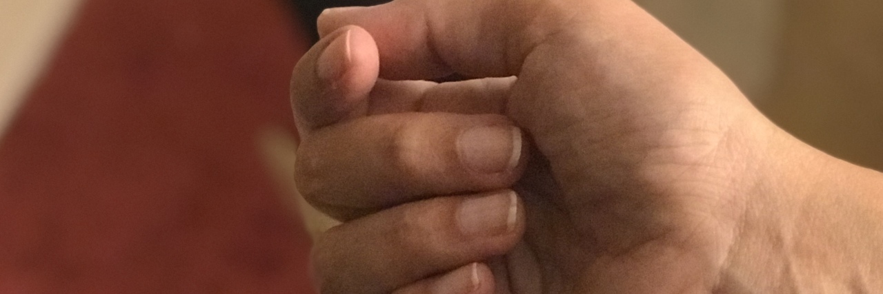 What 'Progress' Means as I Live Life With MS A picture of the writer's right hand, showing how much she can open it due to her MS.