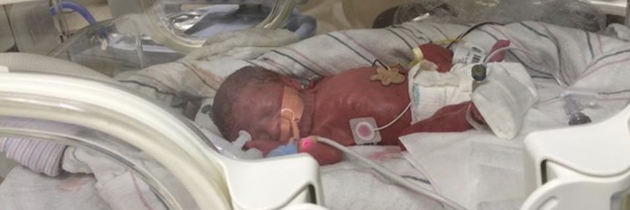Life Lessons From the NICU