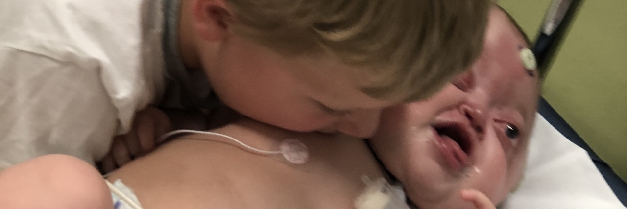 Little baby with disabilities in hospital bed, brother is leaning over and kissing her
