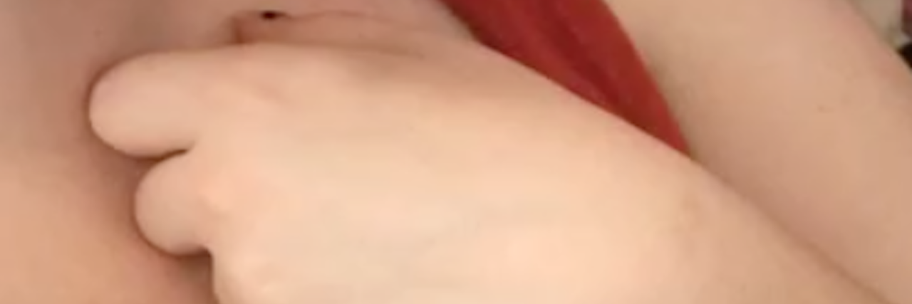 Do I Really Have Parkinson's Disease? The Fear of Misdiagnosis