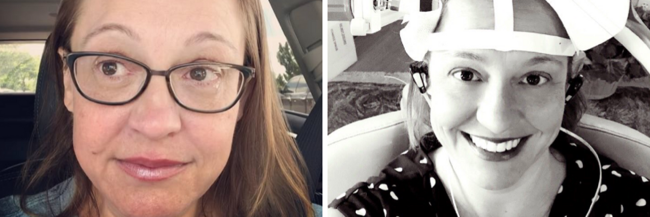 The Bloggess, Jenny Lawson, Shares Video After rTMS for Depression Jenny Lawson (The Bloggess)