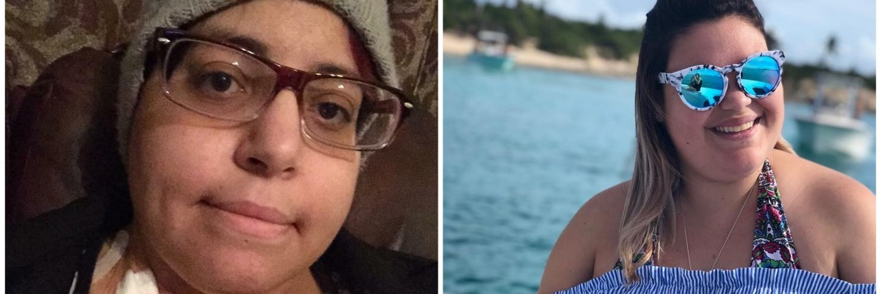 12 Photos You Might Relate to if You've Taken Prednisone woman with port on chest and woman on boat with ocean in background