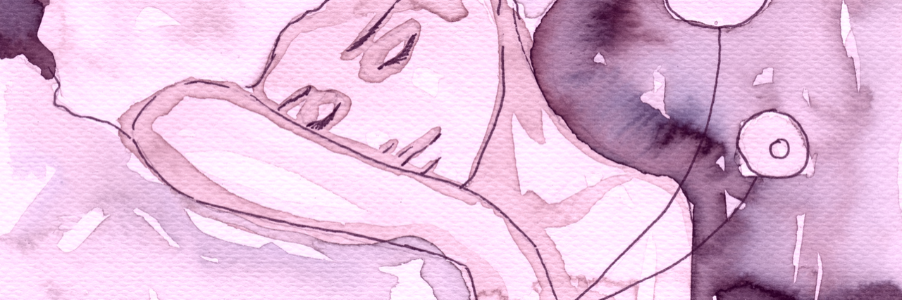 16 Ehlers-Danlos Symptoms That Aren't Just 'Signs of Getting Older' 16 Symptoms of Ehlers-Danlos Syndrome That Aren't Just 'Signs You're Getting Older'