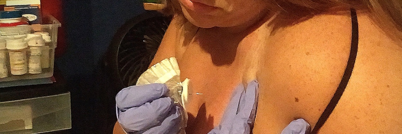 5 Ways People React to My Port-a-Cath A picture of the writer adjusting her Port-a-Cath.