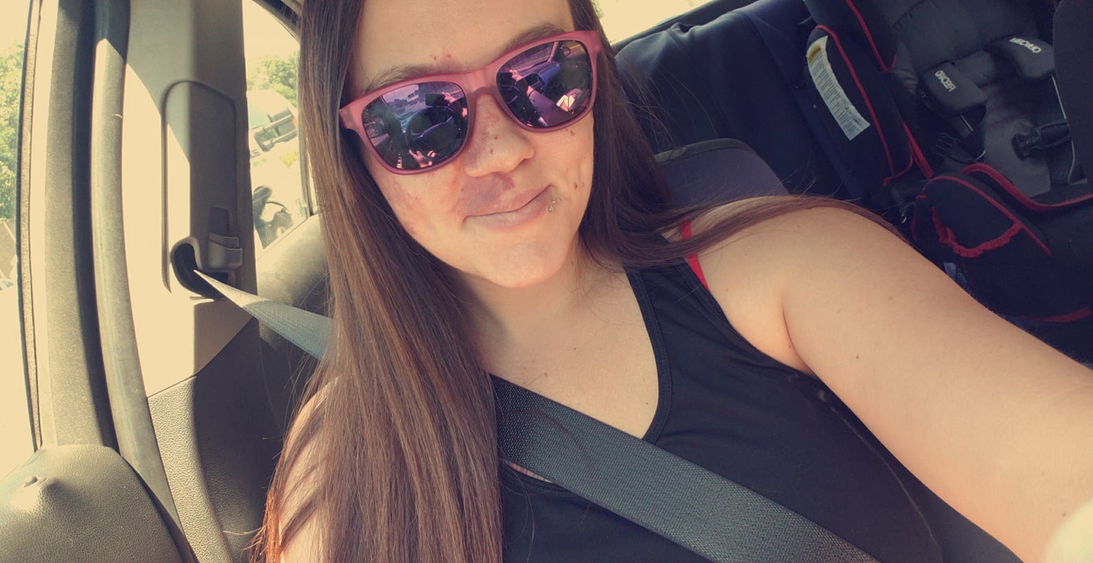 A woman in a car wearing sunglasses, taking a selfie, her birthmark on her lip and cheek.