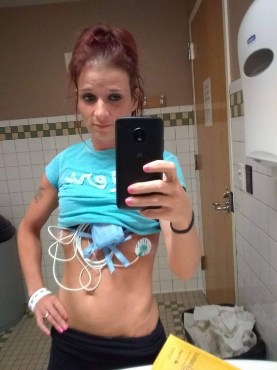 woman taking mirror photo showing electrodes stuck to stomach