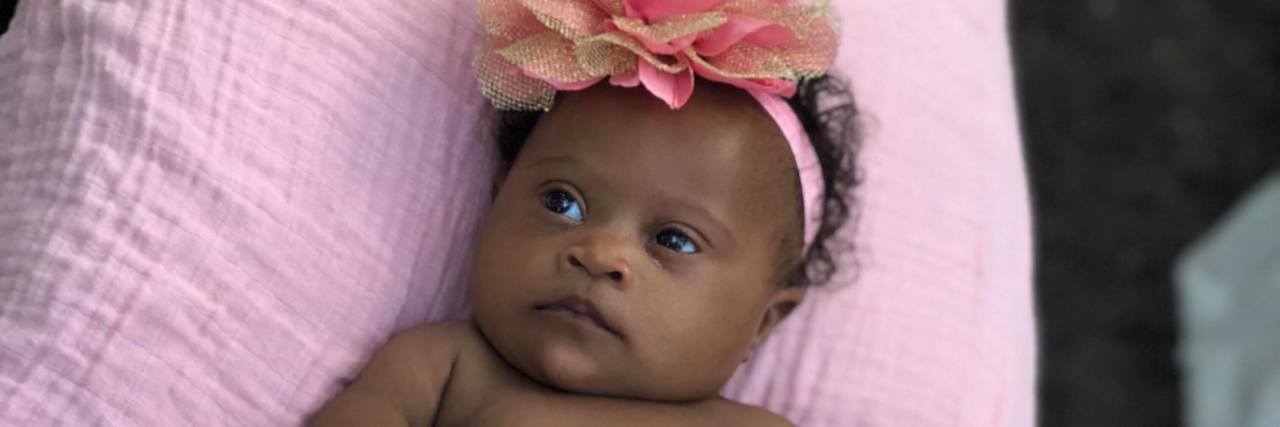 Baby girl with Down syndrome wearing pink tutu and pink headband