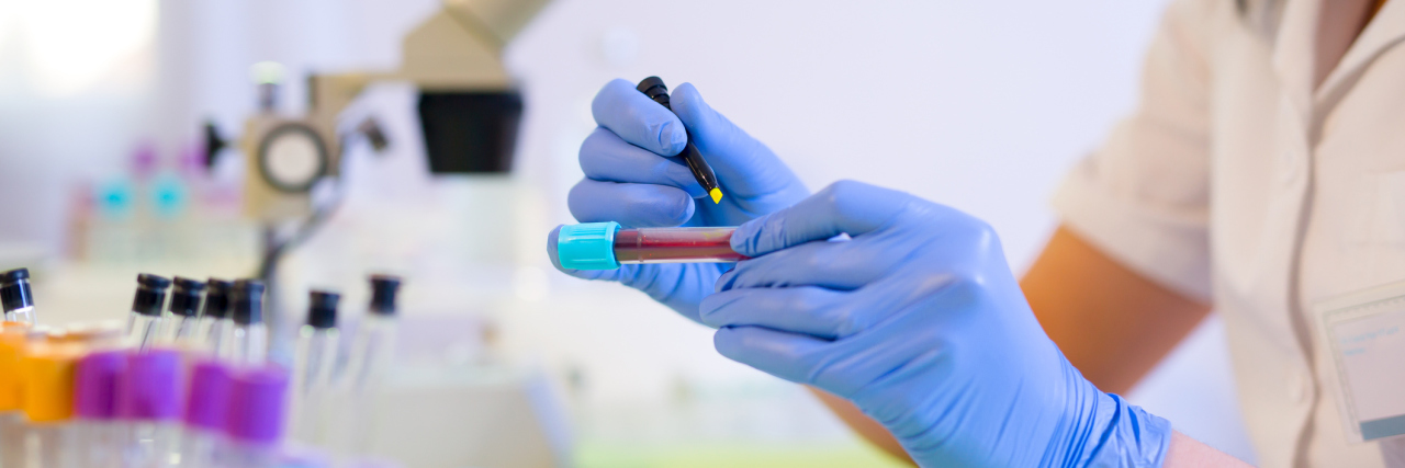 ME/CFS Study Reveals 'Test' That Can Help Diagnose Woman working in a laboratory. He writes with a felt pen. Selective focus