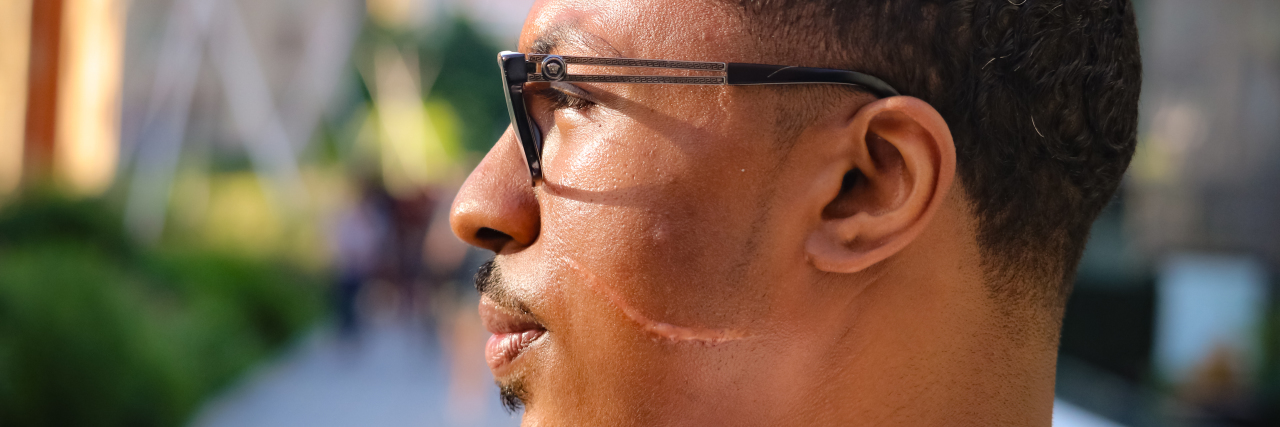 How My Life Has Changed Since Someone Cut Me in the Face man with scar on his face from being cut in an attack