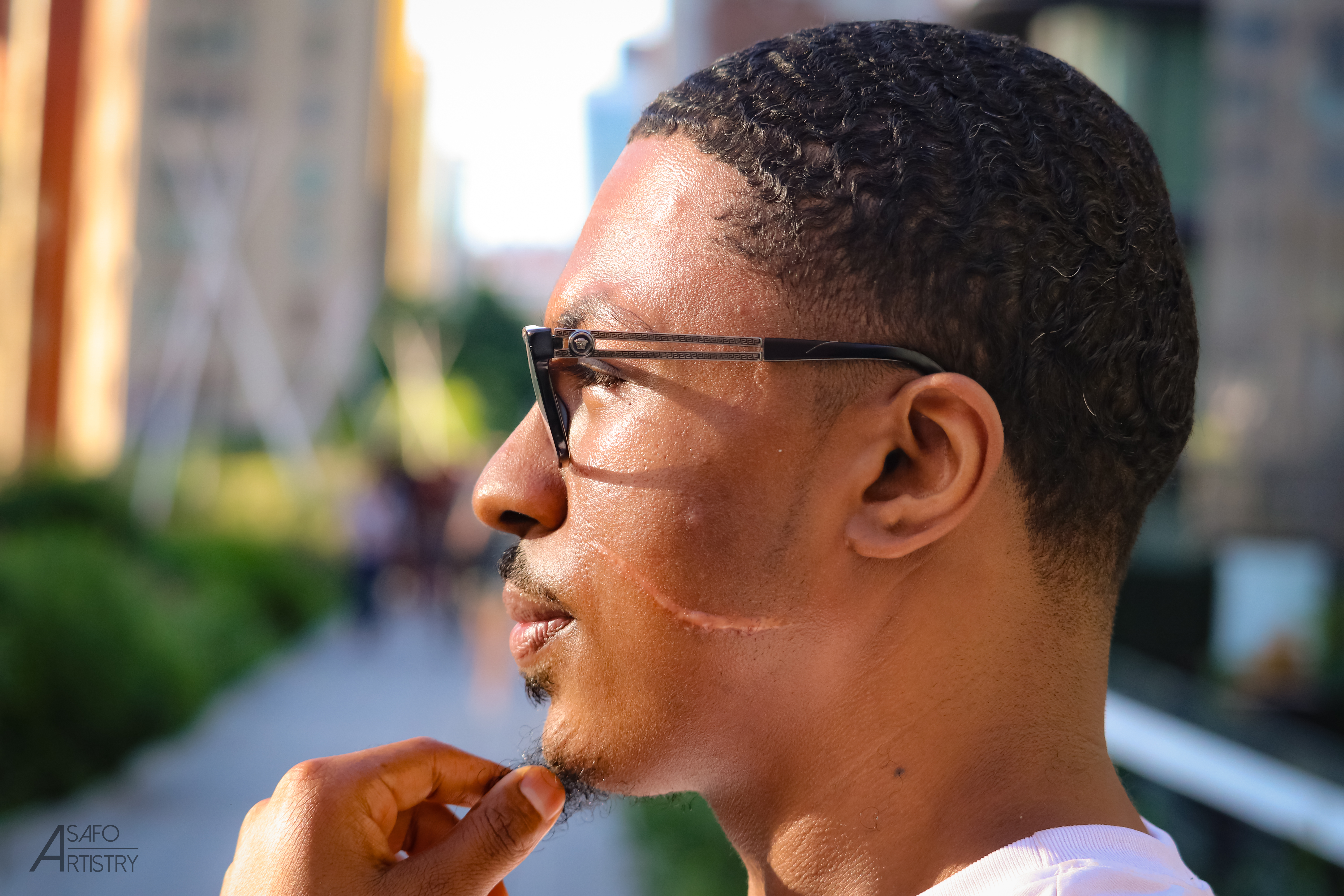 man with scar on his face from being cut in an attack