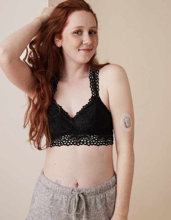 Aerie model with type 1 diabetes