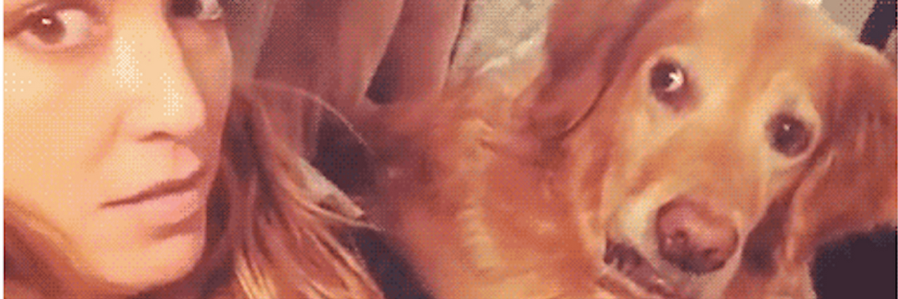 How to Respond to Stares at Birthmark  – According to GIFs dog and girl staring