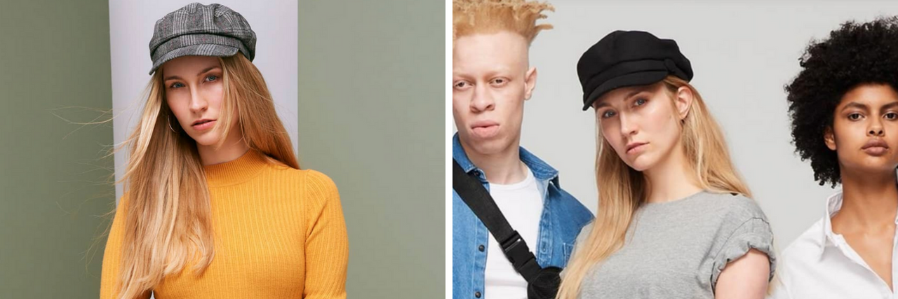 Primark Features Models With Limb Difference, Albinism in New Campaign Kelly Knox for Primark