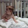 Boy in hospital bed sitting up looking to the side