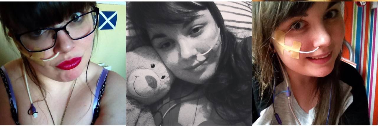 My Experience of Having an NG Tube Placed for the First Time A collage of pictures of the writer.