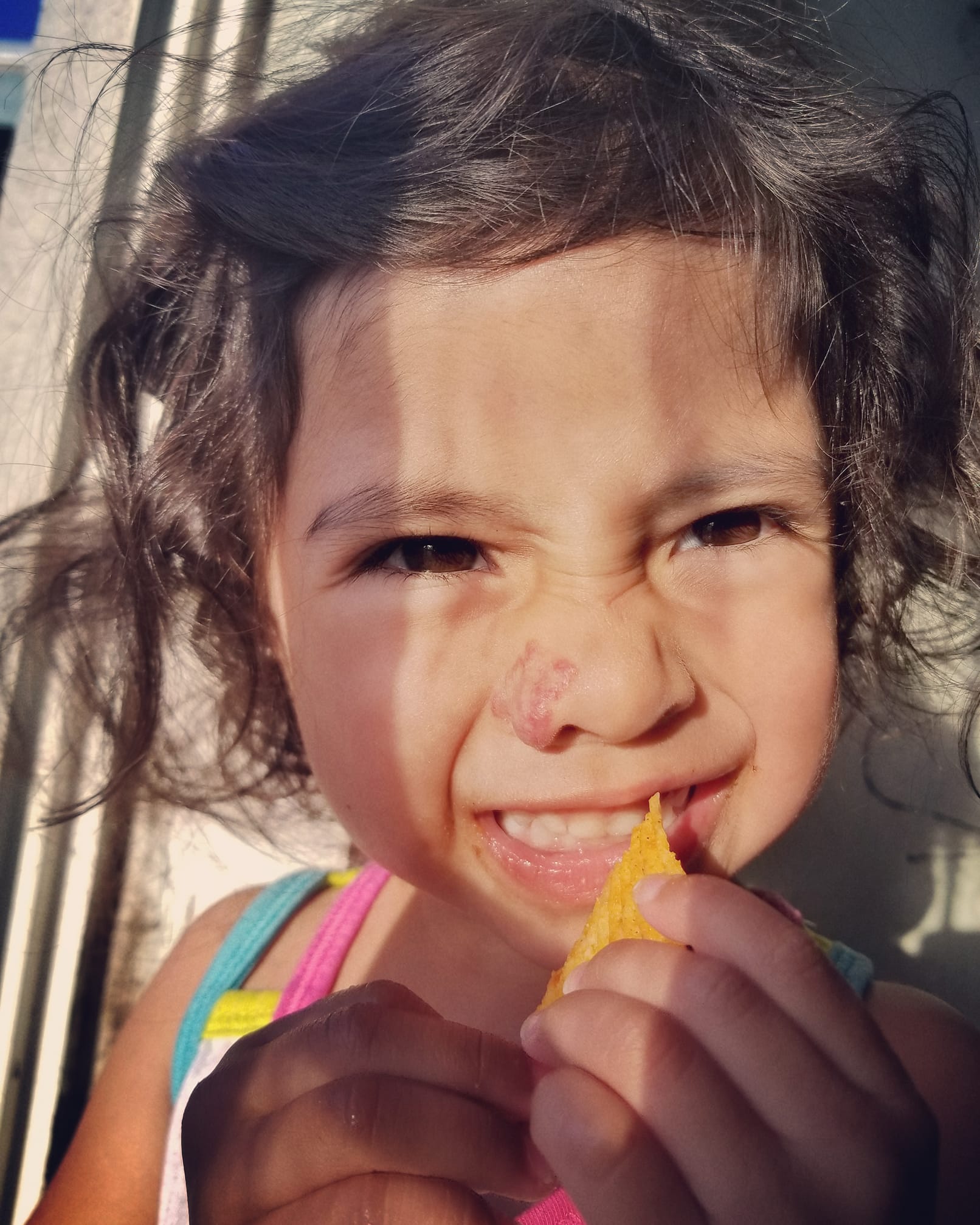 A picture of a little girl smiling, with a birthmark on her nose.