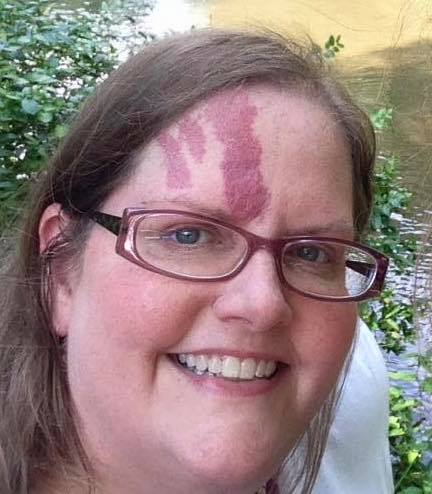 A picture of a woman with a birthmark on her forehead.