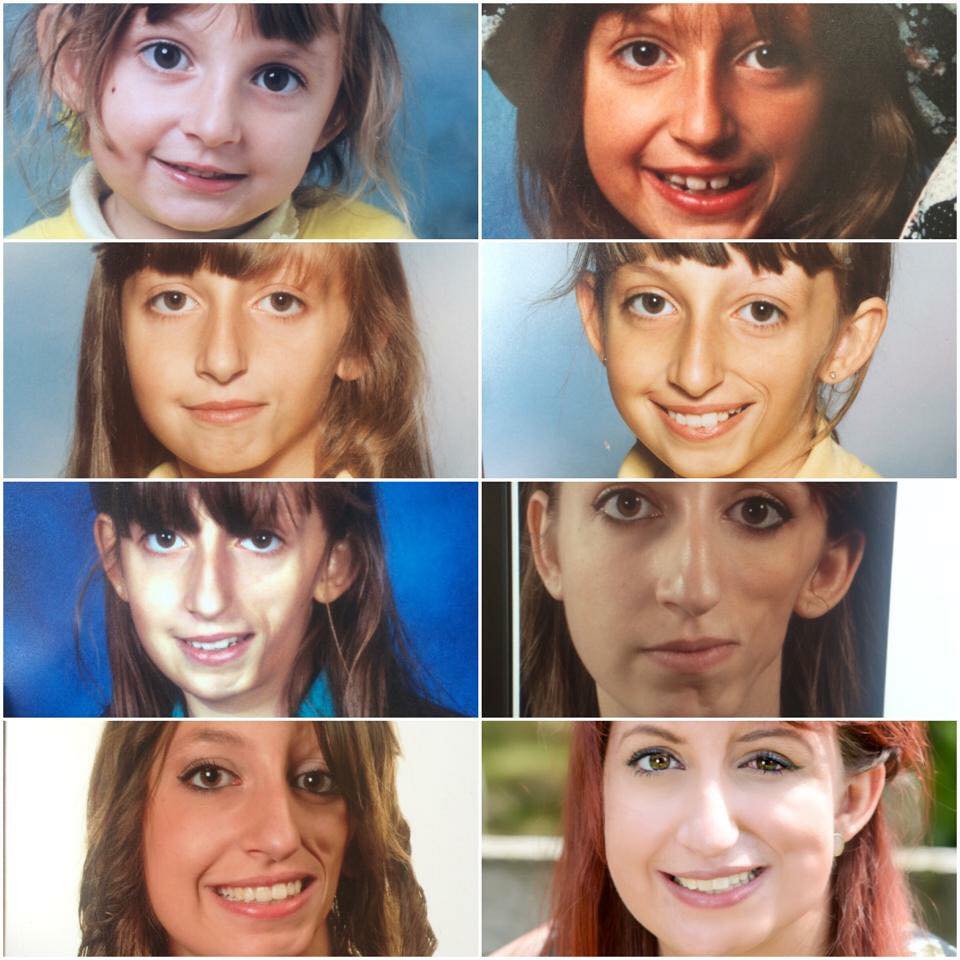 A collage of images of a woman growing up, showing how her face has changed over the years.