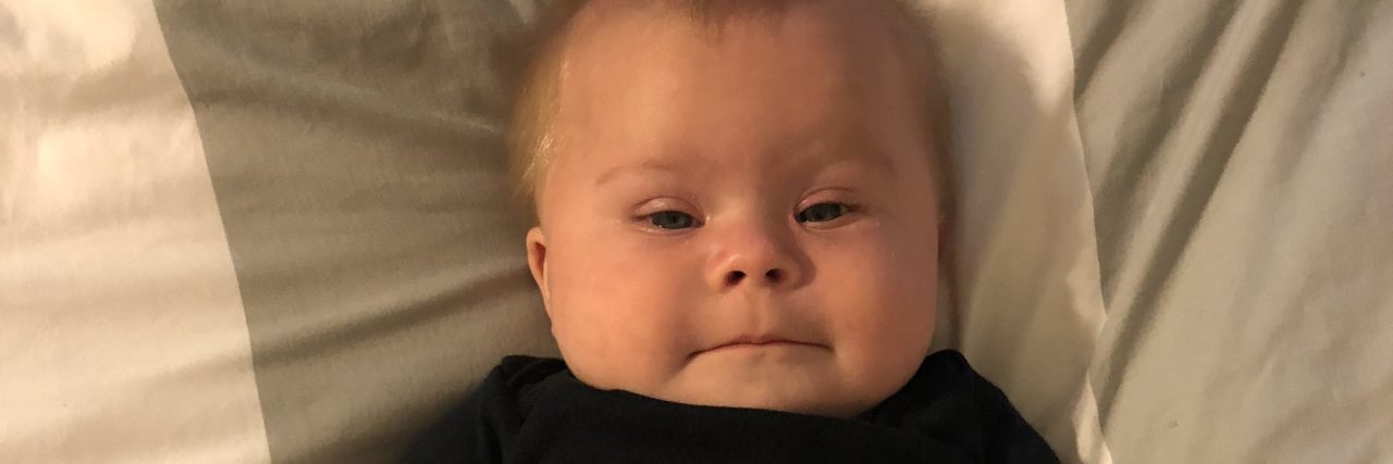 Why I Share My Journey Raising Two Kids With Down Syndrome