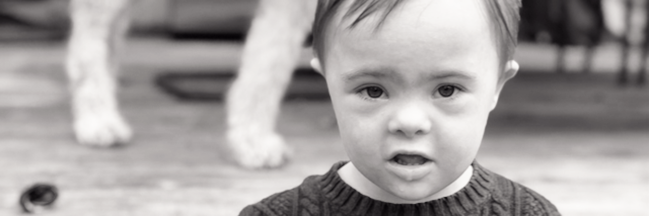 Want to See Inclusion on the Playground? It Starts at School Black and white image of boy with Down syndrome