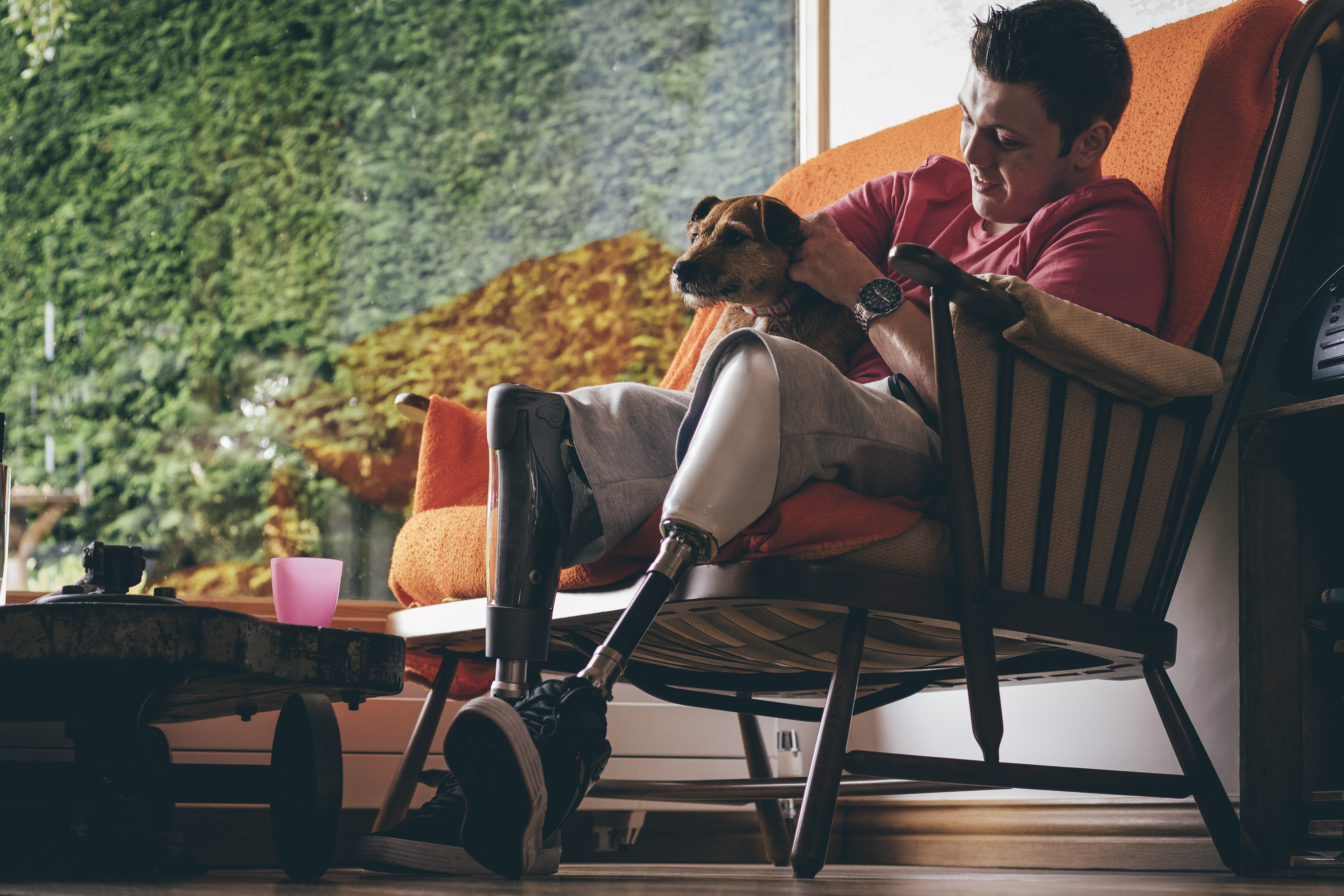 Man with prosthetic legs and his dog relaxing on the couch.