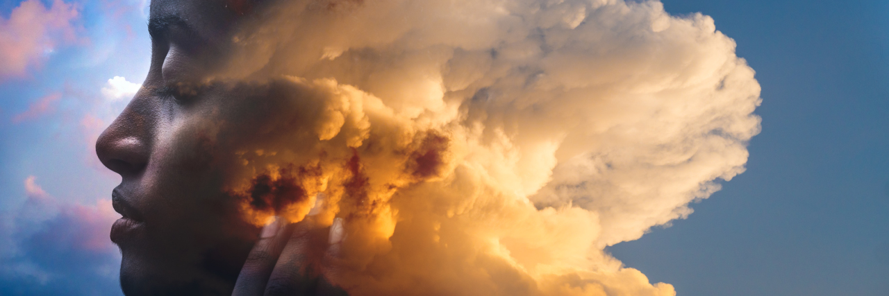 Why I No Longer Listen to 'Never' Statements After My Rare Diagnosis portrait of woman, with clouds passing through