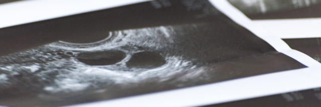 An ultrasound picture