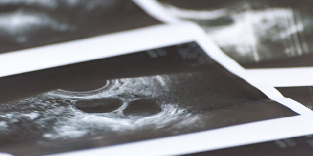 An ultrasound picture