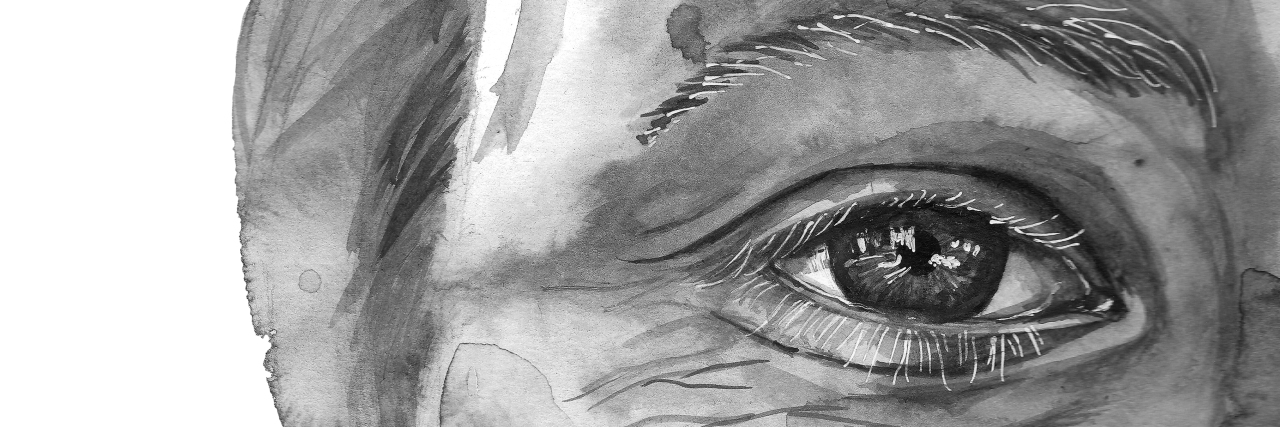 Living With the 'Sleeping Giant' of Facial Pain Watercolor drawing of a man's head