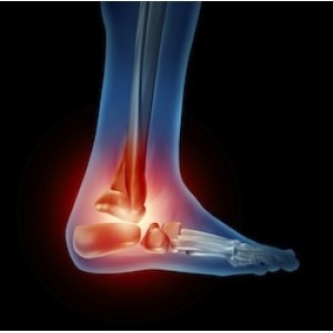 ankle pain stock photo