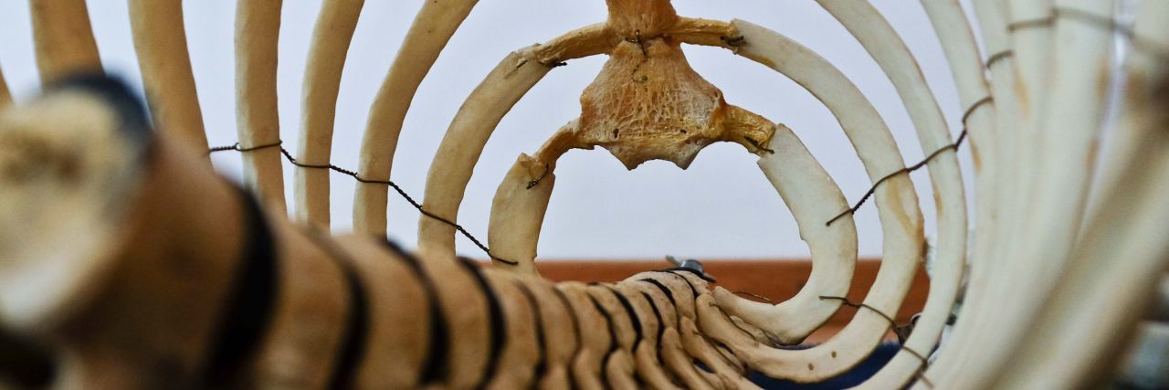 How Illness Since Childhood Is Different Than Adult Onset