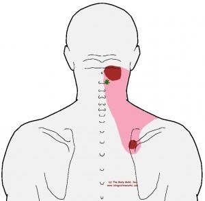 diagram of pain point in person's neck