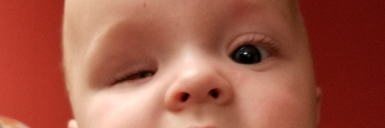 Image of baby, one eye does not seem open all the way.