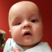 Image of baby, one eye does not seem open all the way.
