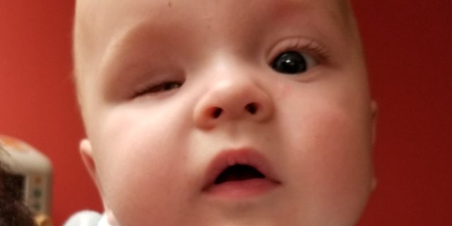 Image of baby, one eye does not seem open all the way.