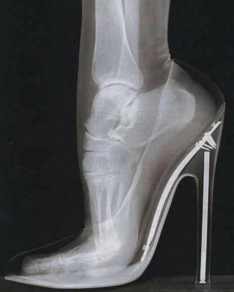 x ray of foot in high heel