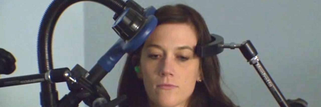 FDA Approves Transcranial Magnetic Stimulation for Treating OCD TMS therapy