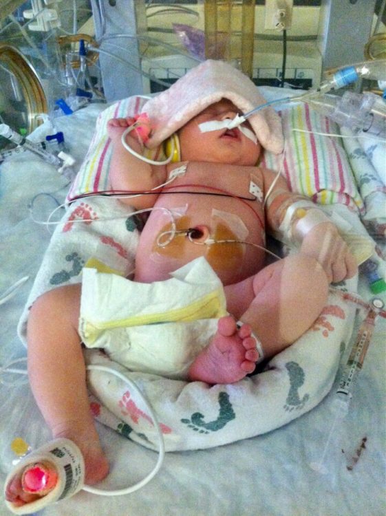 Baby in NICU hooked up to wires and machines 