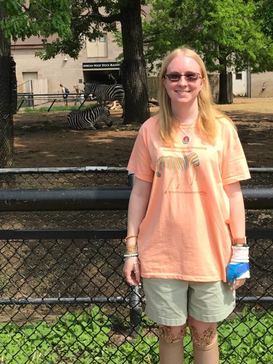 Woman wearing an EDS awareness shirt