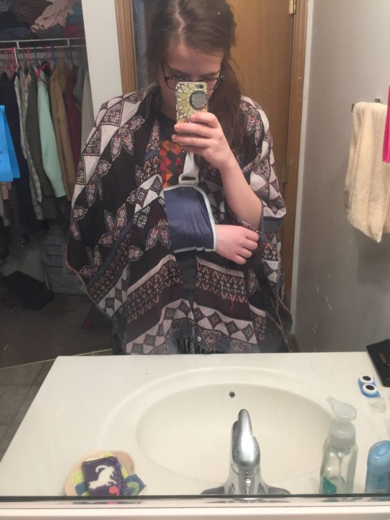 Woman with an arm sling under a kimono