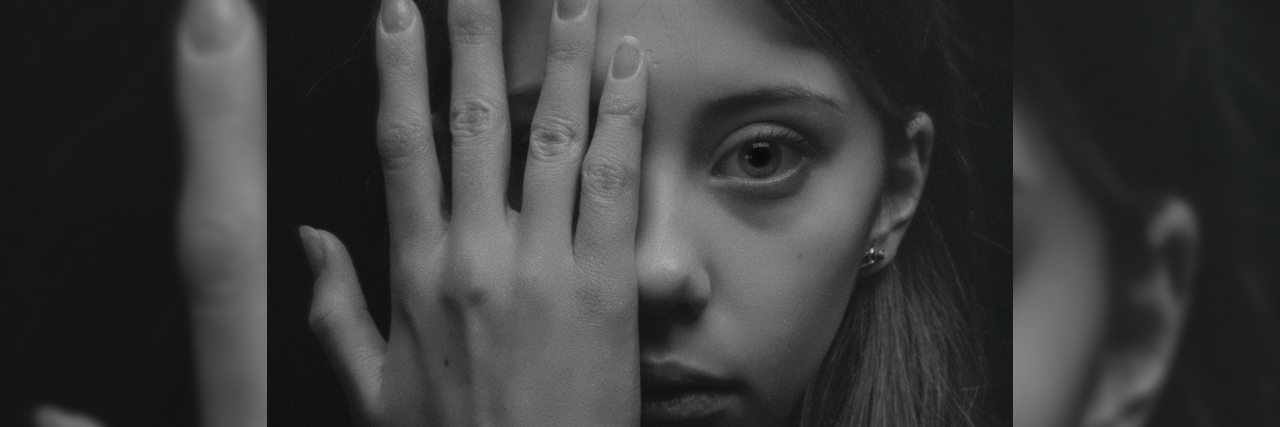 I’m Worried My Anxiety Is Going to Make Me Lose Everyone I Care About woman hand over face