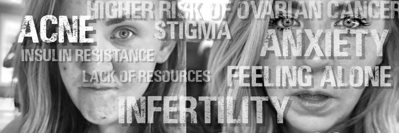 Women Living With PCOS Deserve Better A picture of a woman with pictures of her, and words listing symptoms of PCOS written above her image.