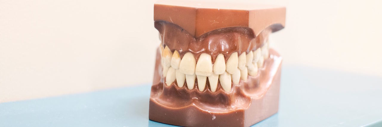 Depression Ruined My Teeth and Dental Hygiene dentors