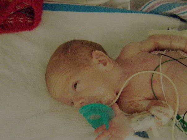 IMage of baby in NICU, covered in wires and with a green pacifier in his mouth