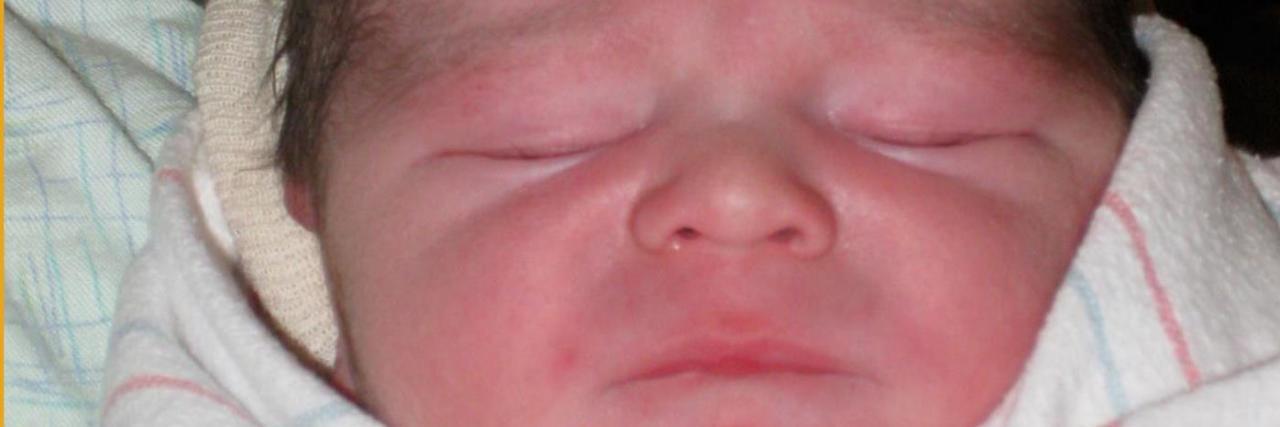 I Want My Son's Death to Shed Light on His Rare Disease The author's newborn baby, side by side with photos of the parents in the hospital