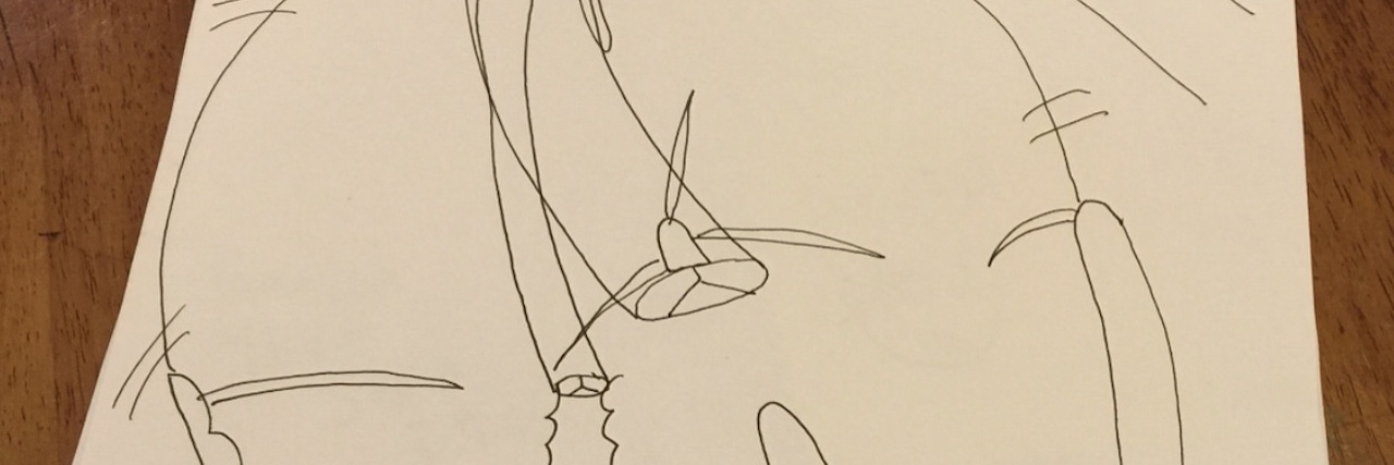 What to Ask When Your Baby's Diagnosed With a Congenital Heart Defect A drawing of a heart with Tetralogy of Fallot.