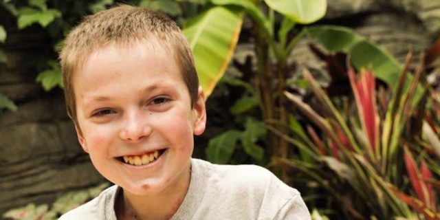 a boy with Epidermolysis Bullosa smiling in front of plants