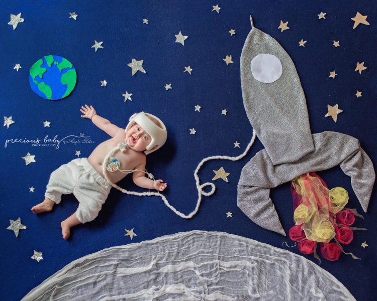 baby with craniofacial difference wearing a helmet, he also has a breathing tube. he is flying through space, his spaceship next to him, his tube connecting him to the spaceship. He is smiling in the sky.